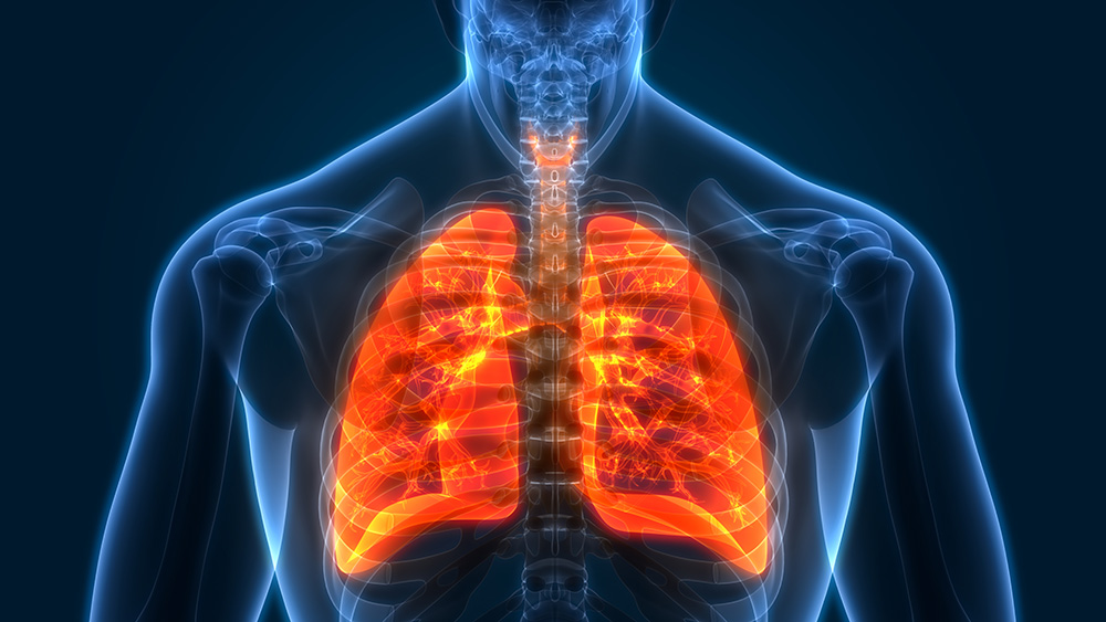 How Do You Test for Lung Cancer? | Keck Medicine of USC